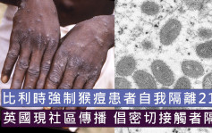比利時強制猴痘患者自我隔離21天 英國倡密切接觸者隔離
