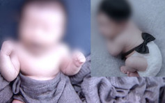 20天大男嬰拍藝術照後患肺炎病危 重慶媽急哭稱太後悔