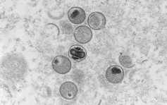 日本报告首宗猴痘死亡病例 患者感染HIV免疫力低下