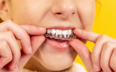 【健康talk】戴牙套矯正牙齒零失敗！牙醫提醒大家箍牙陷阱