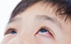 【健康Talk】兒童患青光眼病徵不明顯易忽略 嚴重可致盲