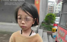 雲南8歲女童遭繼母虐打 雙眼腫脹腳上佈滿淤青