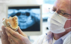 牙醫患致命肺病多23倍 或涉長時間吸入有毒物質