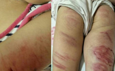 狠父燒烤架打4歲女童　台灣當局不起訴網民氣憤