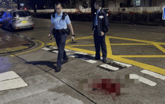 尖沙咀2男遭群煞斬傷  自行乘的士到醫院求醫  現場遺大灘血迹