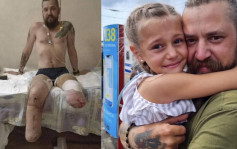 俄烏局勢｜獸醫上戰場 烏克蘭網紅淚訴姊夫雙腳慘被炸斷