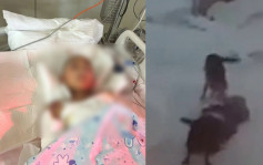 哈爾濱10歲男童遭兩惡犬咬成重傷  已脫離生命危險但很大機會要截肢