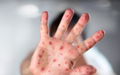 台麻疹事件扩散 冲绳46人确诊恐爆「三次感染」