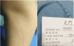 屯门小学生疑被同学刀鎅留6寸伤痕 网民哗然家长报警