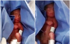 墨西哥醫院誤判23周早產嬰死亡 躺冰櫃6小時後「奇蹟生還」