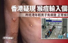 香港現首宗猴痘輸入個案 加拿大抵港男子覆檢後確診