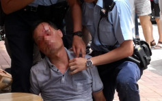 【片段】大埔男涉襲警成面血 遭警壓地制服