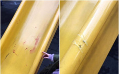 公园滑梯被放刀片 台父刮伤溅血缝3针