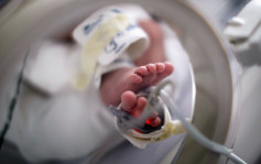 早產嬰瞓保溫箱遭遺留消毒濕紙巾灼傷留疤　家屬獲賠320萬