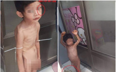 台3歲童疑受虐綁露台全身瘀傷 皮包骨餓到吃糞便