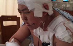 北京男常放屁打嗝被埋怨 捅室友15刀報復致其眼球破裂