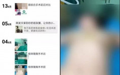 整容医生微信分享无码丰胸手术片段 工商局介入：已涉违规宣传