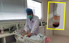江蘇2個月大嬰兒被抽出「牛奶血」 因家長沖奶粉習慣所致