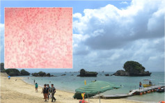 【游日注意】衞生防护中心：对麻疹无免疫市民 不应往冲绳