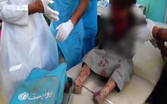 沙特联军空袭也门击中巴士 最少29名儿童死亡30人受伤