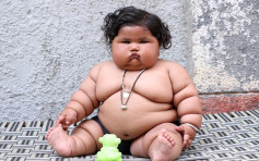印度8个月大女婴体重如4岁童　脂肪太厚难抽血