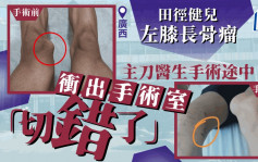 左右不分︱广西17岁田径健儿左膝长骨瘤   医生手术错切右膝
