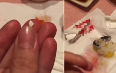 壽司食出瓷碎片｜女顧客被劃傷口腔流血  廣東日式料理店賠千元私了