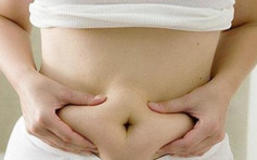 担心「肥死」令子变孤儿　安徽胖妇年减115公斤