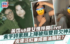 黄沾48岁女黄宇诗憔悴开Live成面油脂粒？ 素颜上阵皮肤泛红被指双目欠神采