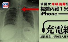 波蘭女呼吸困難送院 揭體內藏1米長iPhone充電線