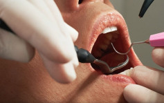 政府擬限牙科生實習1年  牙醫學會前會長 : 料可提供更多公營牙科服務