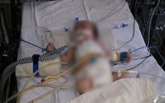 印度女婴惨遭28岁表哥性侵 内脏受损命危