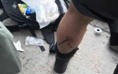【修例風波】傳媒聯絡隊警員左小腿中箭 受傷送院