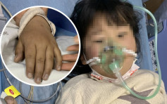 5歲女童吃自家製泡菜中毒 嘴唇發紫險喪命