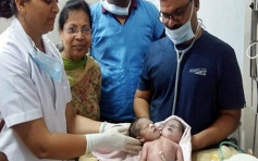 印度年轻妇人诞下畸胎 男婴2头3臂4手掌