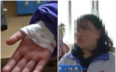 贵州中学生遭体罚致手掌出血 伞柄折断仍继续打