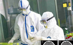 北京地坛医院首次证实 新冠病毒攻击中枢神经系统