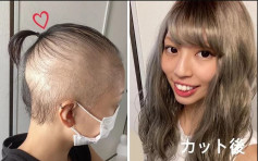 日本年轻女注射莫德纳疫苗后 一个月后变秃头