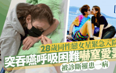 28岁同性恋女星紧急入院！突吞咽呼吸困难吓窒睡梦中爱妻  被诊断罹患一病