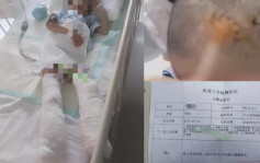 冻水浸脚、滚水烫头 江苏5岁男童被生母虐待致截肢
