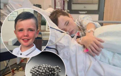 英9歲童仿抖音挑戰吞磁珠險死 4小時手術切腸保命