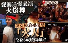 有片｜美女表演火焰舞變「火人」 全身八成燒傷命危  餐廳安全措施惹爭議