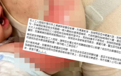 沙田1歲男嬰被抱住廚房煲粥 右手半身二級燒傷 菲傭涉虐兒被拘控