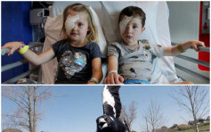 澳洲频现「恶霸喜鹊」 2幼童惨遭啄伤眼恐失明