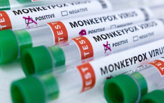 猴痘蔓延至美國所有州 累計逾14000宗確診 