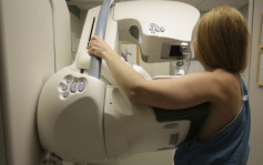 預防乳癌︱美醫療機構修訂標準  女性40歲起應每2年接受1次檢查