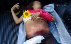 不孕巴西女拐孕婦 血腥劏肚搶嬰被捕