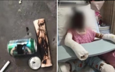 山東兩女模仿網上鋁罐製爆米花致爆炸 其中一人重度燒傷