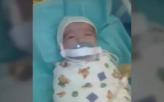 12周大俄婴被塞奶嘴封胶纸 警方介入调查