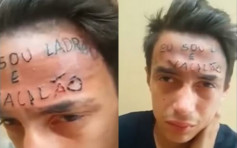 企圖偷單車斷正　17歲青年遭行私刑額頭紋「我是小偷」